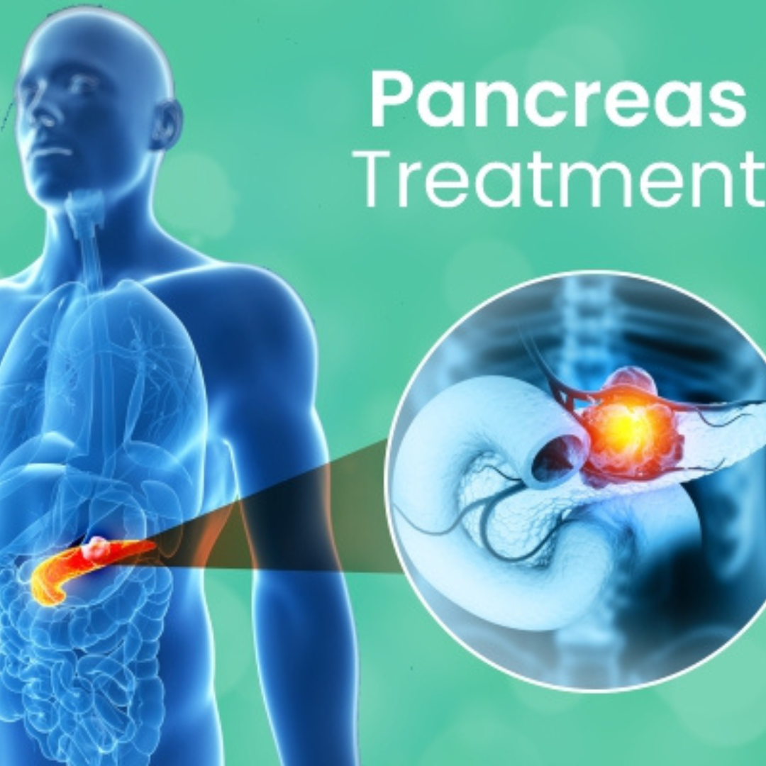 Best Pancreas Treatment in North Delhi