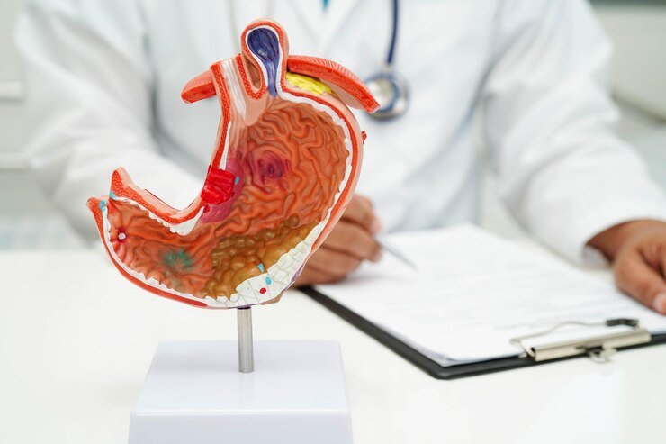 Best Hospital for Gastroenterology & Hepatology in Rohini