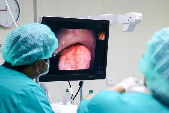 Best Colonoscopy Doctor in Pitampura