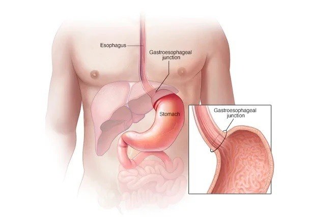 Best Stomach Doctor in Pitampura