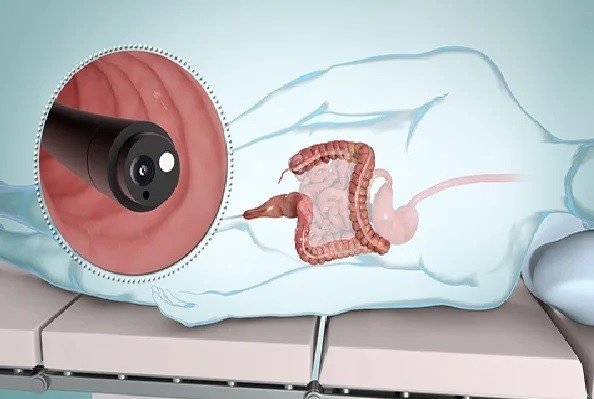 Best Doctor for Flexible Sigmoidoscopy in Rohini