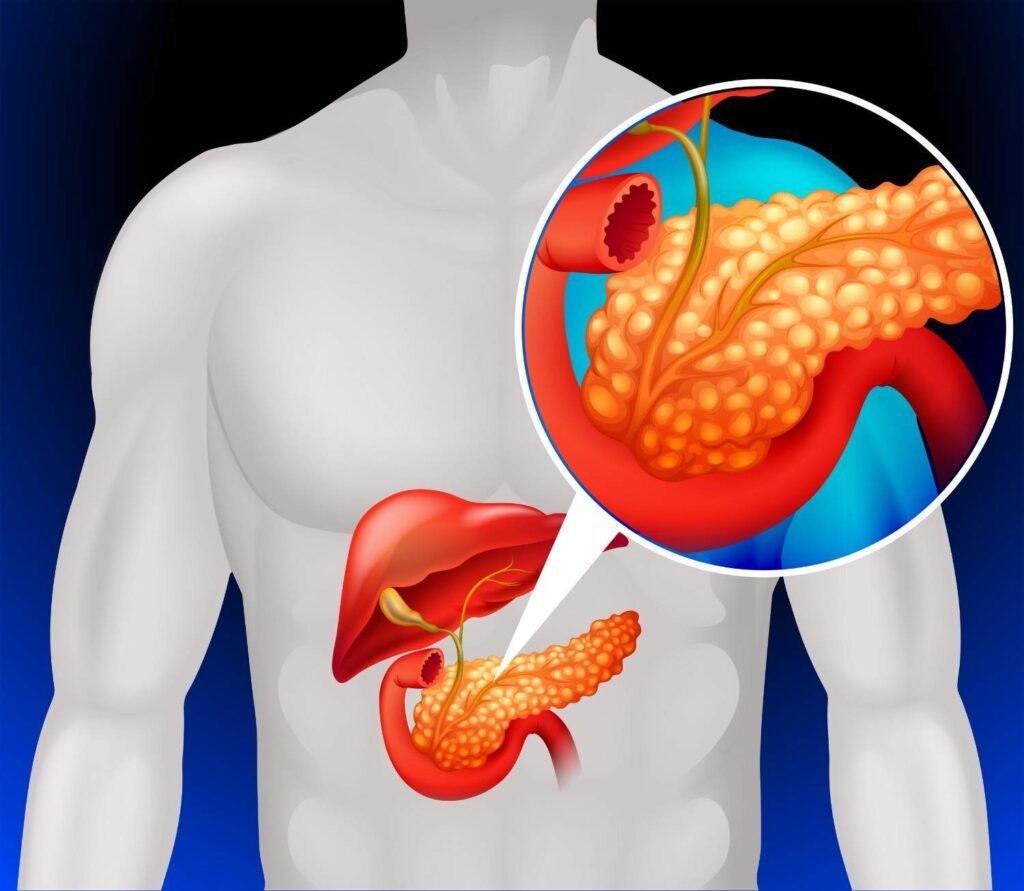 Best Doctor for Pancreas Treatment in Rohini