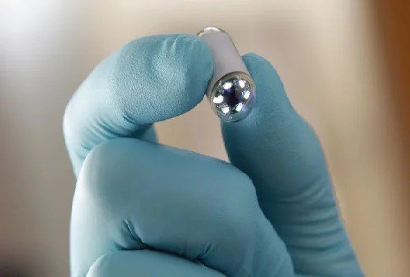 Capsule Endoscopy in Rohini